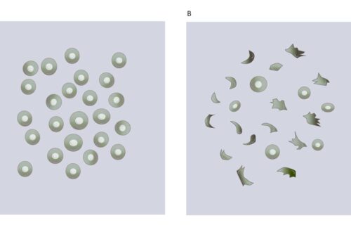 Simple Sickling Test Procedure