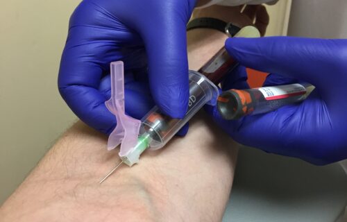 Common Phlebotomy Errors
