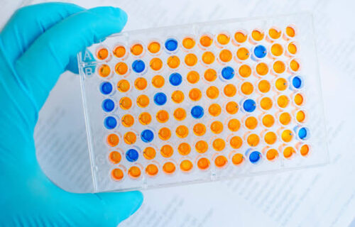 Understanding ELISA Testing (Enzyme-Linked Immunosorbent Assay)